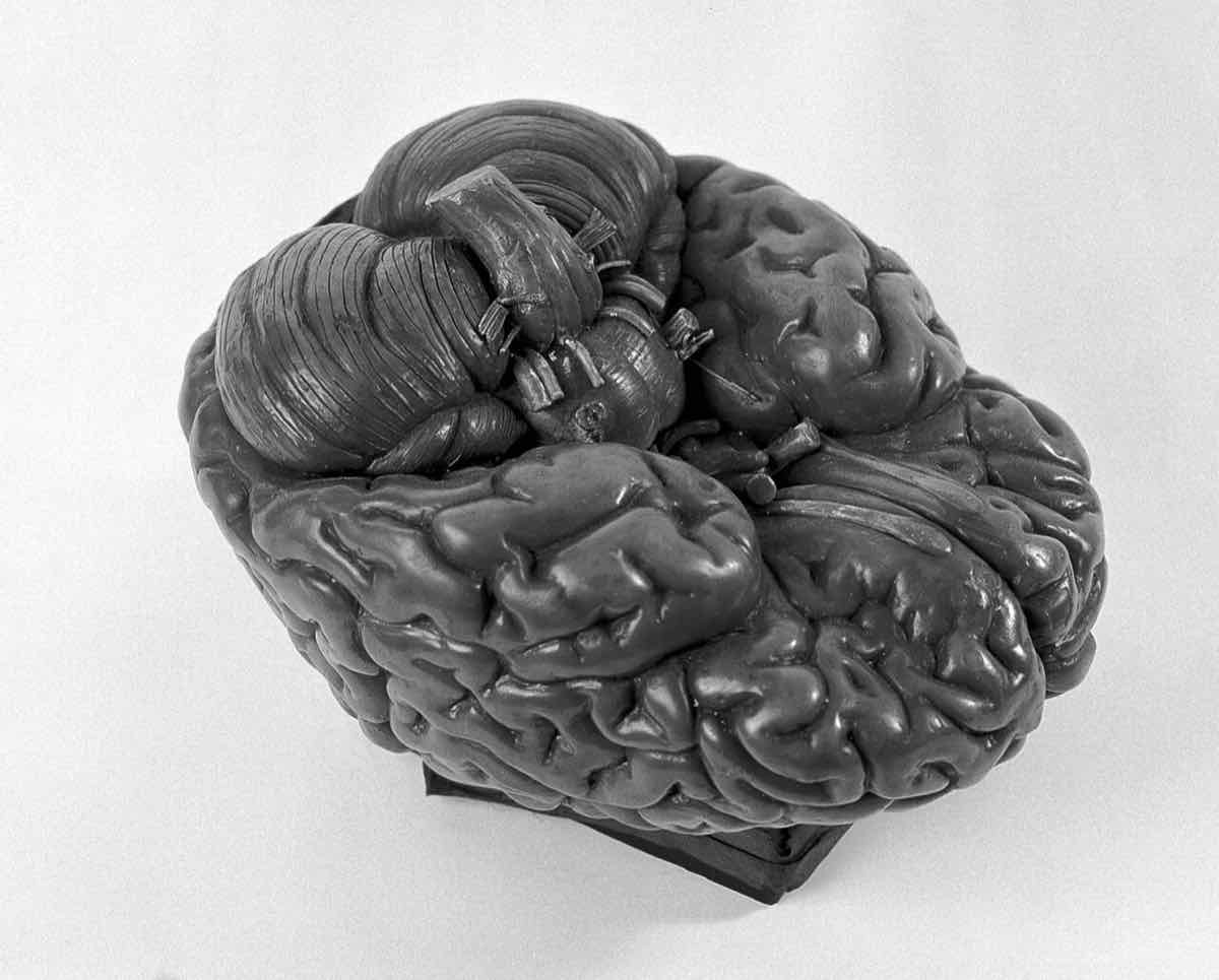 human brain anatomical model
