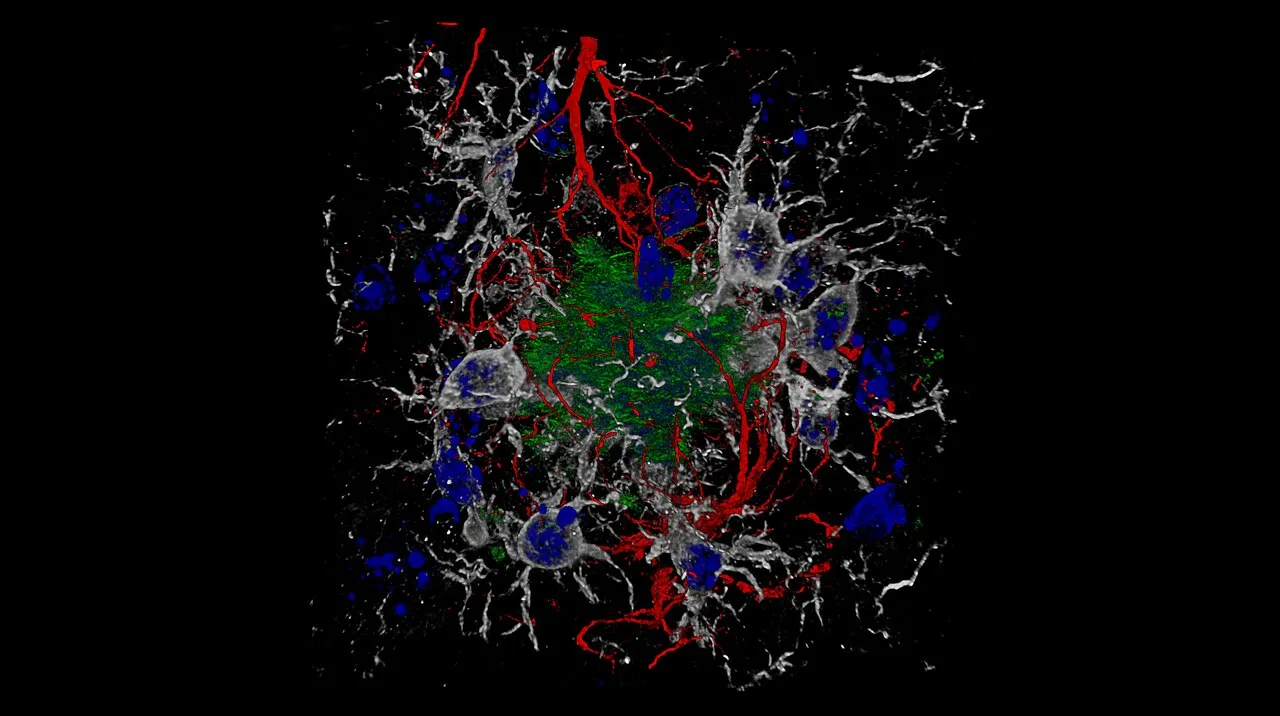 astrocytes fluorescence microscopy